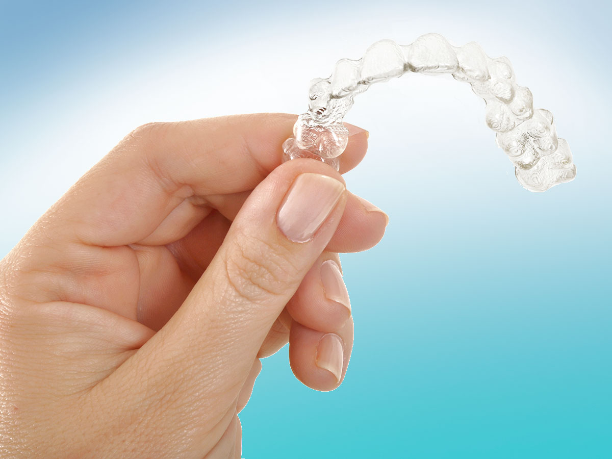 Shine Orthodontics Clear Aligners